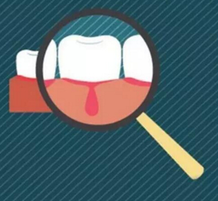 两面针提示：春季口腔问题高峰期，牙龈出血需关注